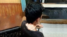 Insiden Pembacokan di Desa Gerung Permai, Suaralaga, Lombok Timur Dipicu Masalah Uang Rp 2 Ribu. (Foto: Lombokini.com).
