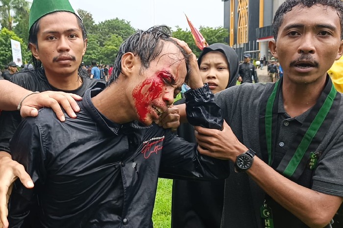 Salah seorang Pengunjuk Rasa Terluka dan dilarikan ke Rumah Sakit, Kamis 22 Januari 2026. (Foto: Lombokini.com).