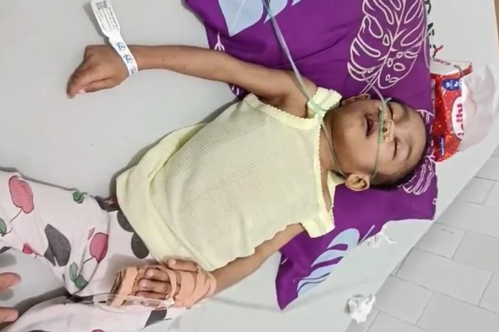 Dari Pulau Terpencil, Ibu dan Anak Cerebral Palsy Berjuang Lawan Gizi Buruk dan Infeksi Paru. (Foto: Lombokini.com/Istimewa).