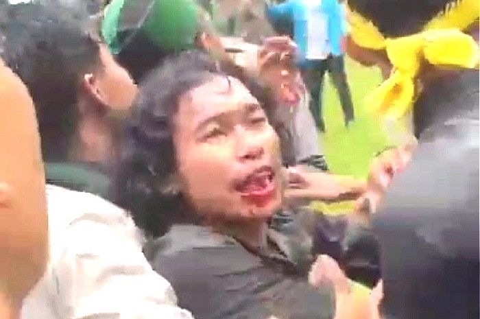 Dua Kader Himmah NWDI Luka Berat Usai Bentrok dengan Aparat di Kantor Bupati Lombok Timur. (Foto: Lombokini.com/Tangkapan Layar).