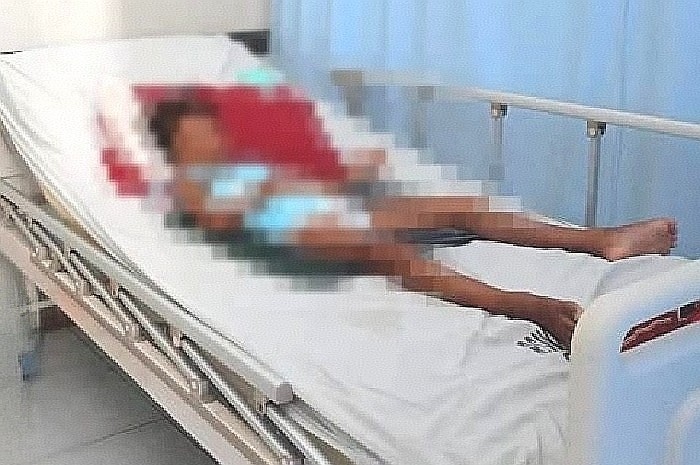 Siswa Kelas 1 SD di Lombok Timur Diduga Alami Patah Tulang Akibat Diinjak Teman. (Foto: Lombokini.com/Dok. Pribadi).